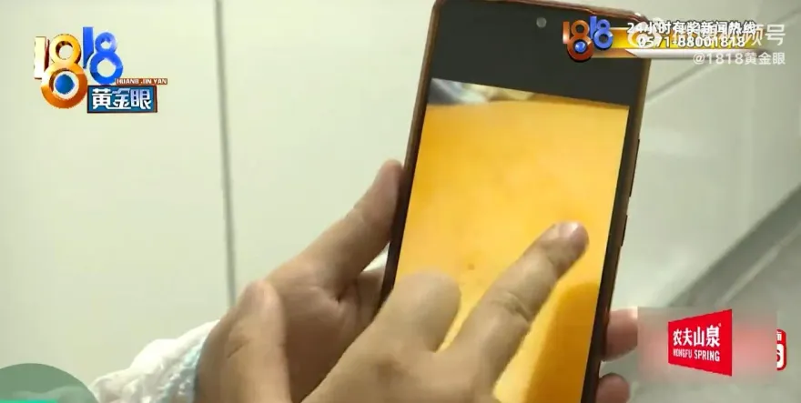 影/豆腐做的？被男同事「拍一下背」她1年沒上班　稱中「鐵砂掌」索賠18萬