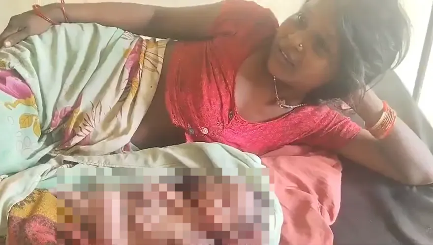 影/罕見！印度女子生下「2張臉4隻手臂」嬰兒　僅存活5小時就夭折