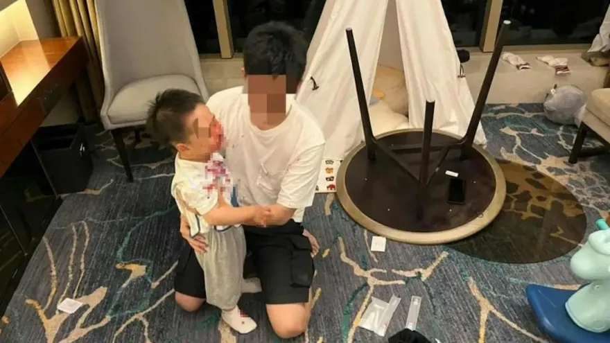衣服都是血…2歲童被親子房圓桌砸中險毀容　上海五星級酒店：無安全隱患