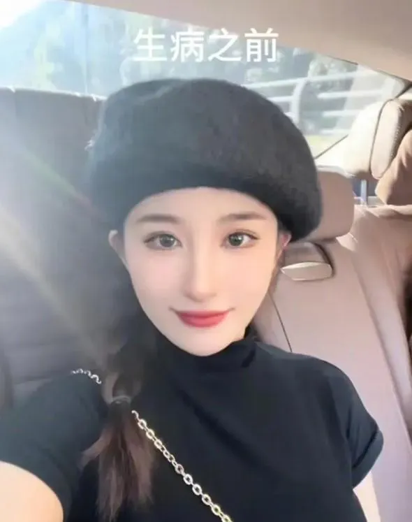 確診漸凍症僅8個月離世！湖南26歲美女曾嘆「等不到春暖花開」