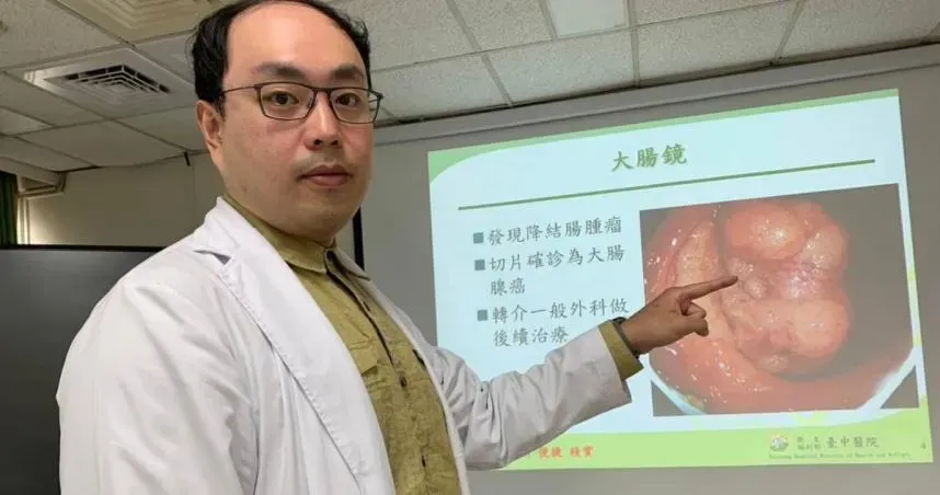 健檢揪出貧血！台中女就醫竟是早期大腸癌