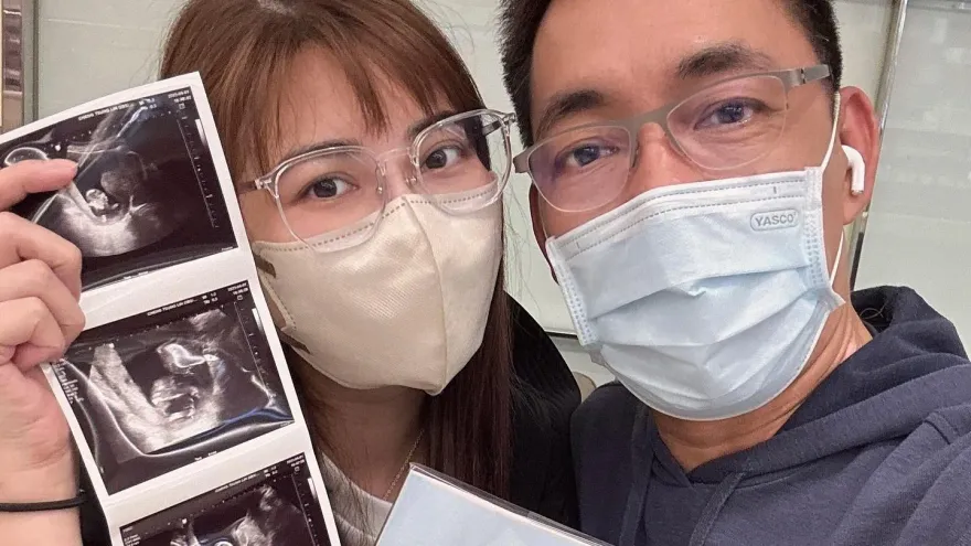樓心潼宣布懷2寶！超音波照藏「愛心」　嗨喊：可愛小腦袋