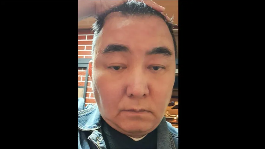 徐亨自曝「確診水腦症」急動刀　變肥、右耳幾乎聽不見