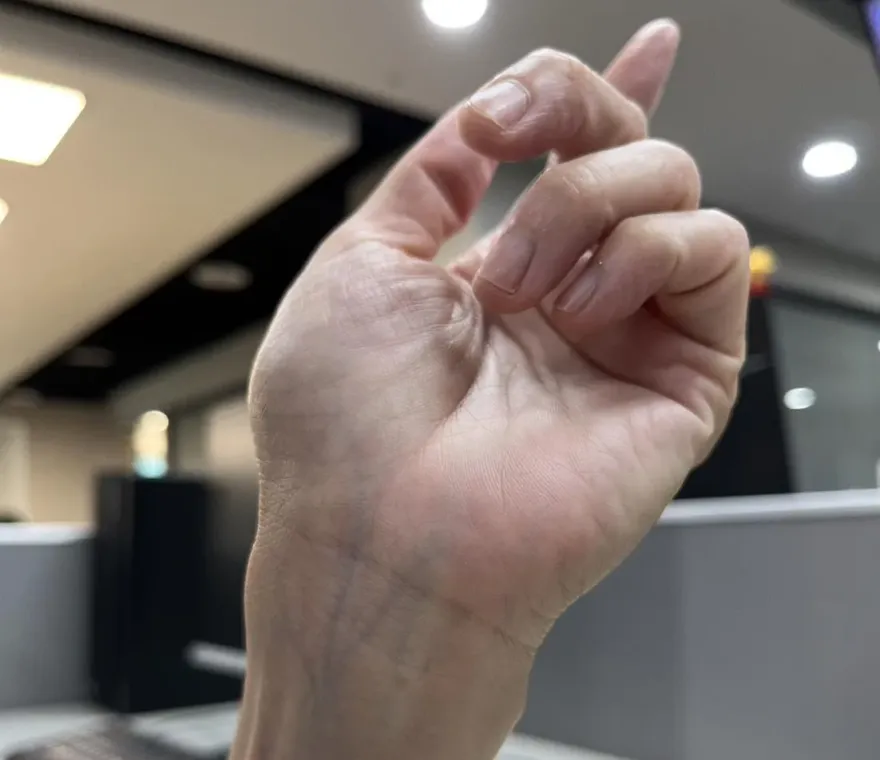 靜脈血管是身體「天然透視鏡」！脖子常冒青筋恐是心臟衰竭