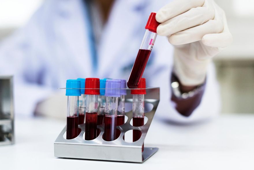抽血就能驗大腸癌？專家揭敏感度僅五成：難取代糞便檢查