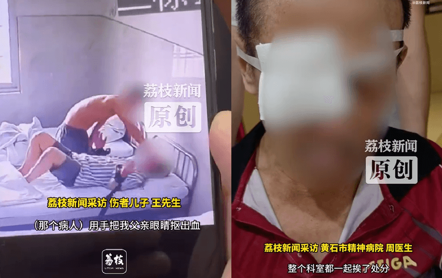 陸翁住院遭精神病友「摳出眼球」失明　兒崩潰：父雙手被綁