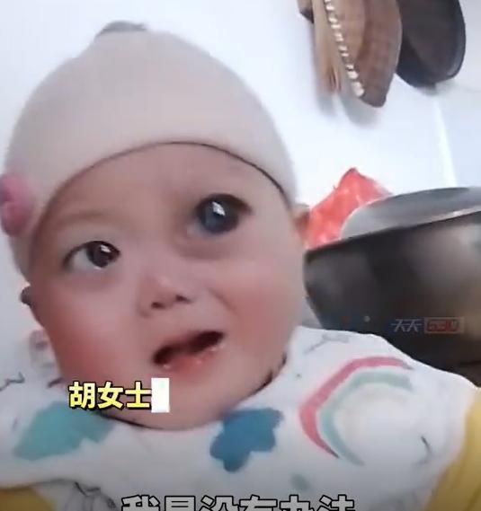 影/陸男嬰罹罕病眼睛「腫如燈泡」　父不願養狠心離婚