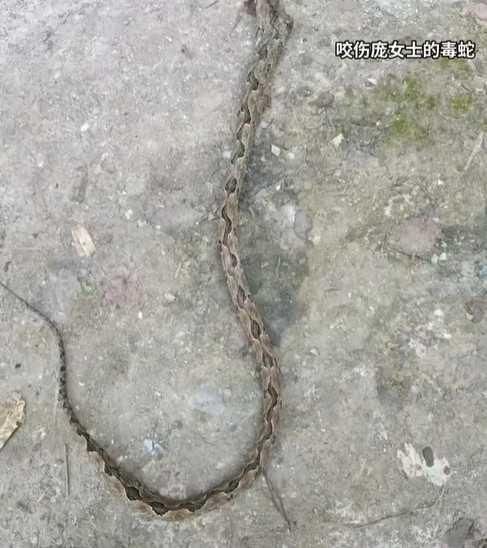 一條值4百萬！陸婦遭「全球最貴毒蛇」咬傷　醫曝嚴重後果