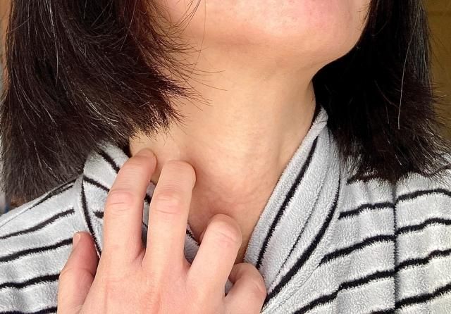 全台30萬患「異位性皮膚炎」又癢又痛！近8成陷憂鬱