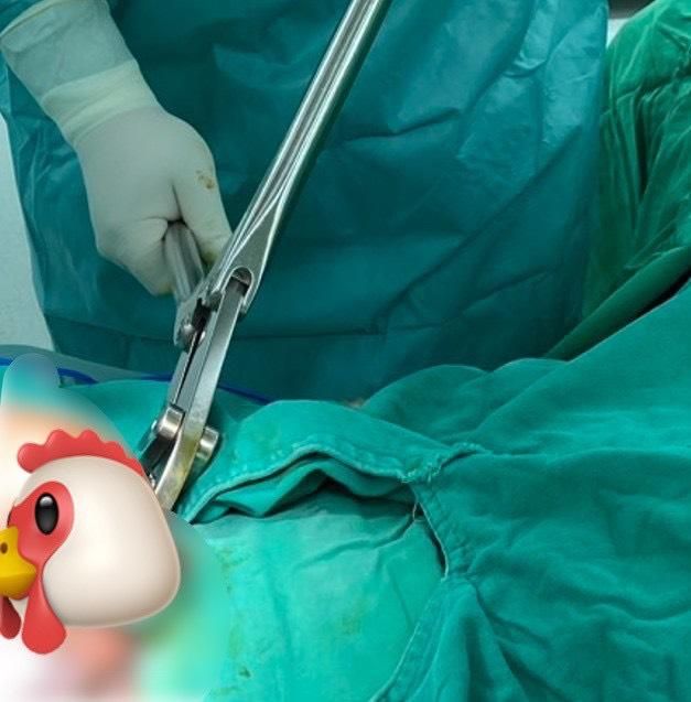 玩過頭！「延時環」卡死命根…腫成象拔蚌　險釀組織壞死