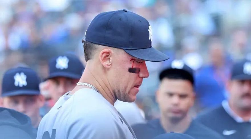 MLB/賈吉臉被砸濺血！洋基禍不單行　苦吞6連敗