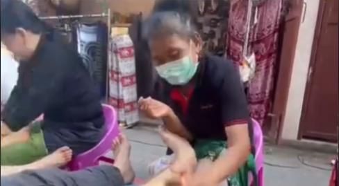 花5美元鬆一下慘中招！遊客泰國路邊攤按摩　竟換來滿腿膿包