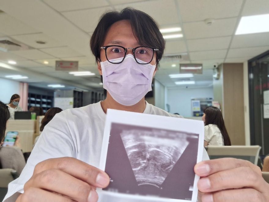 張啟樂當爸了！曬超音波照　嗨喊愛妻懷孕是「意外驚喜」