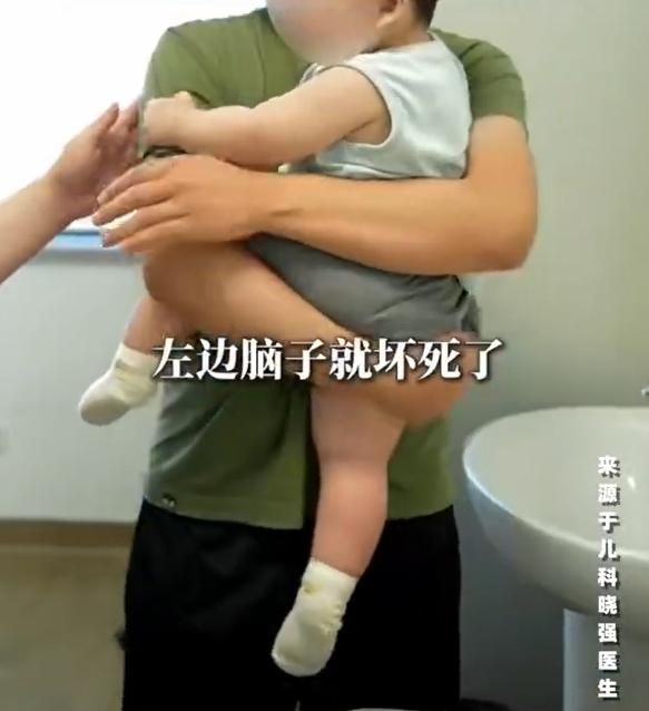 哄睡猛搖「晃到寶寶腦損傷」　陸新手爸懊嘆：1歲還不會爬