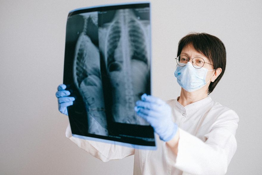 年輕工程師「堅持做肺癌篩檢」　醫驚：竟有毛玻璃結節