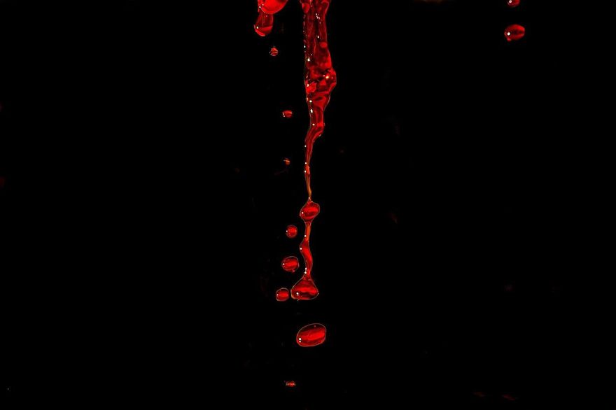 史丹佛研究「一滴血揭腦齡」可預測失智風險