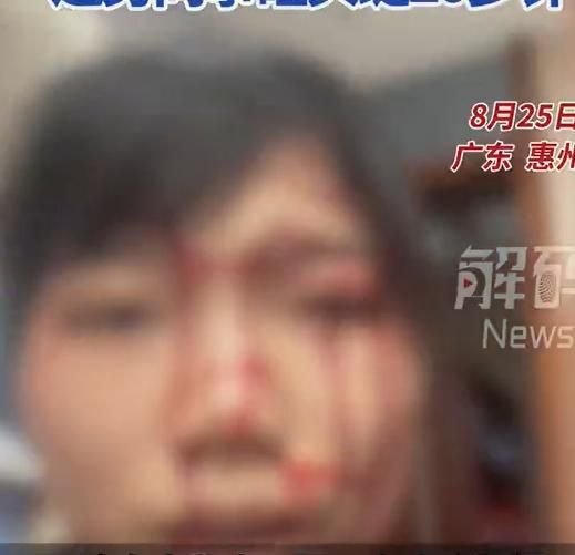 嚇！陸女問同事「訂金怎麼退」對方突抓狂　遭馬克杯狠砸頭噴血