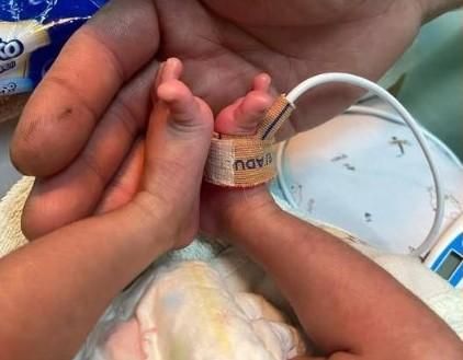 台南早產兒「小平安」順利轉院　母感動曝取名由來