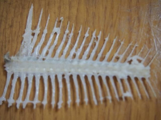 翁腹脹、食慾差就醫　醫胃鏡一照驚見「3公分大魚刺」