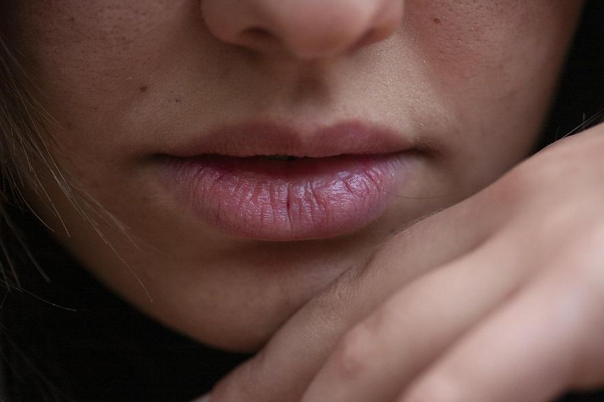起床見「嘴唇上有白膜」纏身一週　醫：恐非小事快就醫