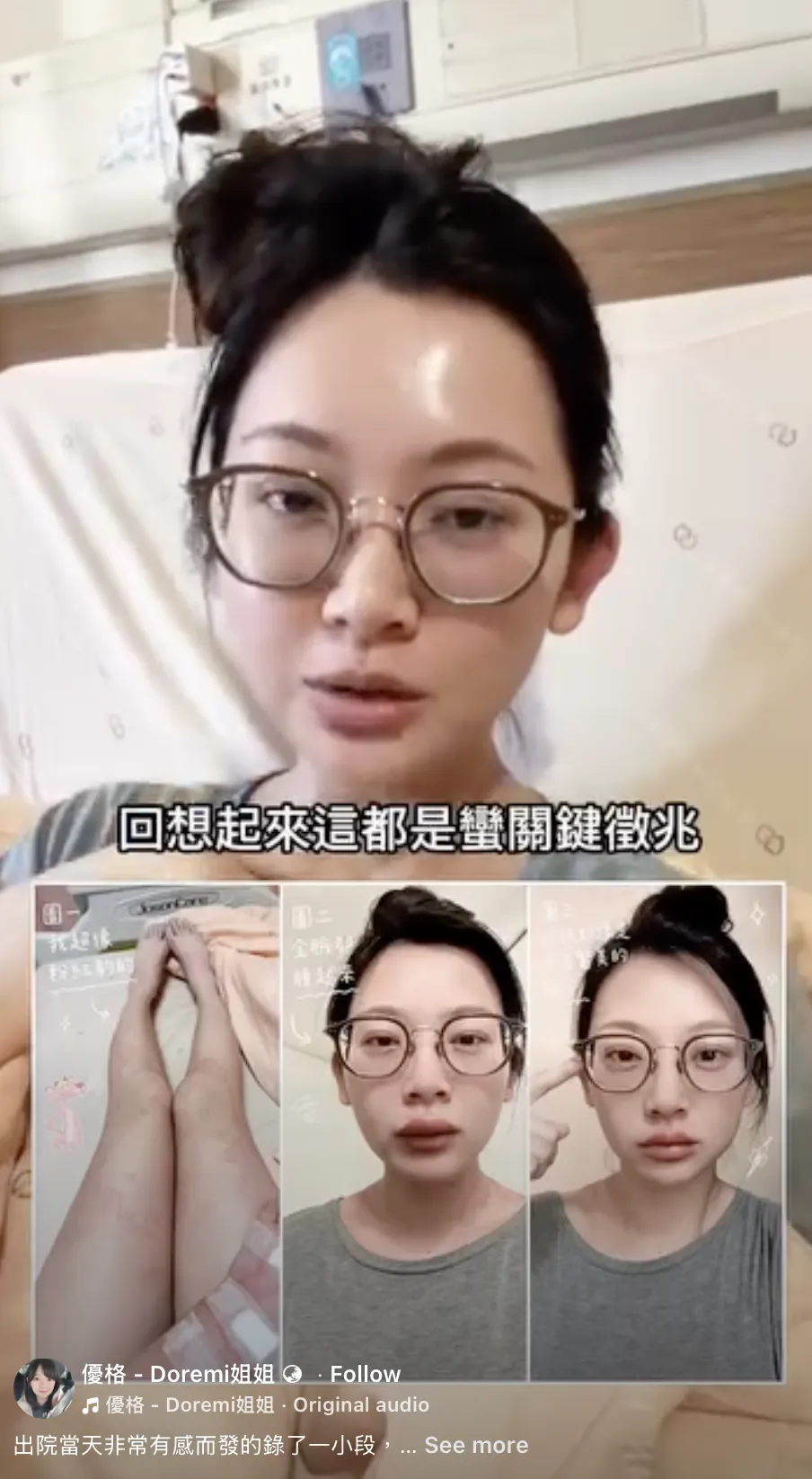 優格姐姐回顧發病過程，整理出6大關鍵警訊，提醒大眾千萬不可輕忽蕁麻疹。（圖／翻攝自優格姐姐臉書）