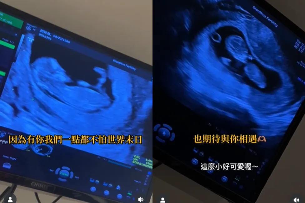 Ivy向寶寶喊話「期待與你相遇」。（圖／翻攝自Ivy IG）