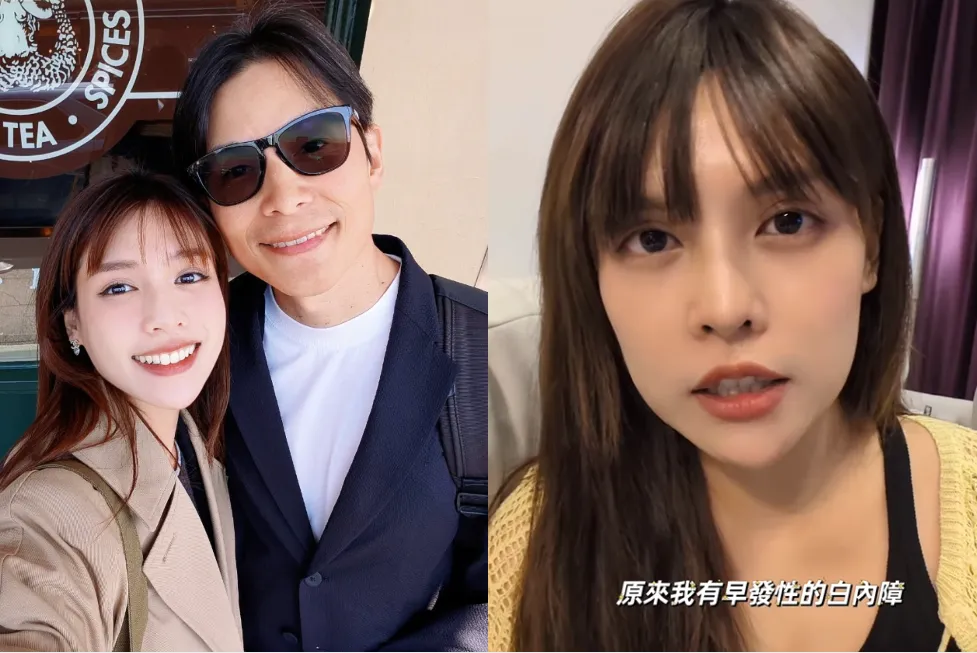夏宇童透露近期就醫被診斷出有早發性白內障。（圖／翻攝自夏宇童IG）
