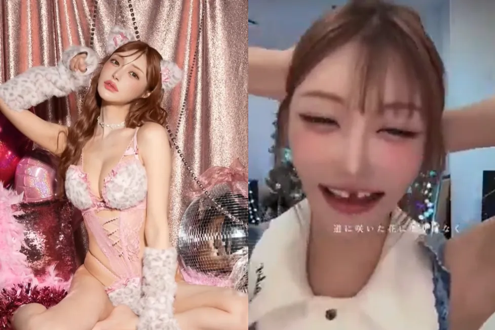 明日花綺羅近日少了一顆門牙。（圖／翻攝自明日花綺羅IG、X）