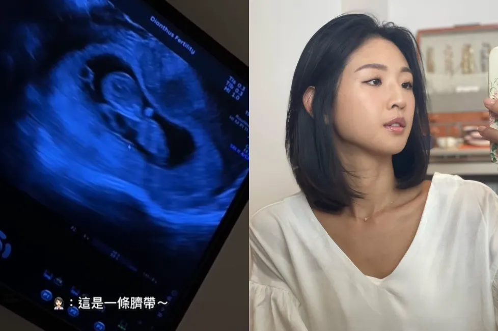 Ivy 5日曬出超音波照，宣布懷孕喜訊。（圖／翻攝自Ivy IG）