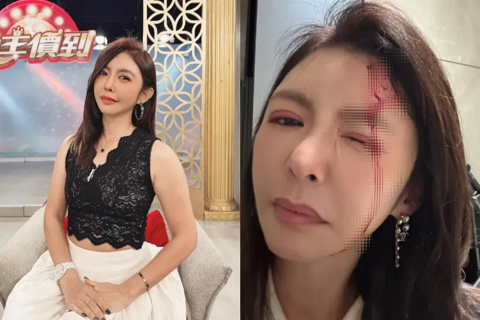 李芳瑜透露近日出門前被老公亂放的單槓機勾到，導致她跌倒後頭破血流。（圖／翻攝自李芳瑜臉書）