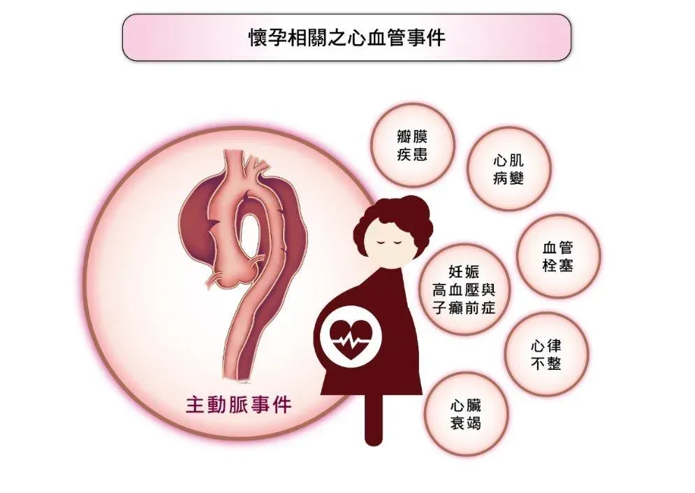 懷孕相關之心血管事件。(圖/長庚醫院提供)