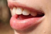 用嘴巴呼吸易吸入更多病菌！牙醫師曝4危害：容易蛀牙、感冒