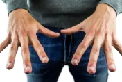 好痛！「凍甲」原因曝光　醫：4種治療方式：指甲內嵌後續要矯正治療