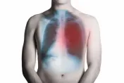 氣喘與慢性阻塞性肺病重疊「肺功能退化更快」！醫籲1危險因子要遠離