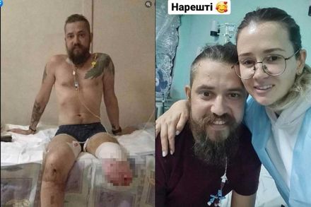 接送傷員遭砲擊！烏克蘭網紅姐夫在戰爭中失去雙腿　女兒心疼大哭