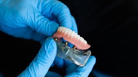 怎麼挑假牙？牙醫師解密3種假牙優缺點 !