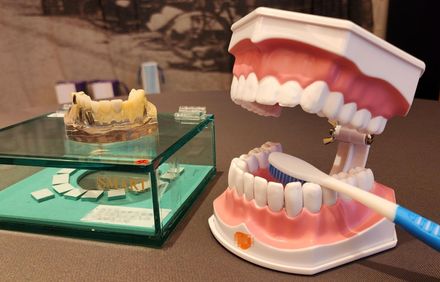 國人8成都有「這病」！57歲婦牙齒鬆動又出血　原來是罹患嚴重「牙周病」！