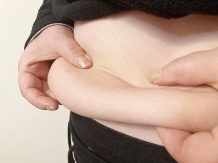 肥胖症不忽視！專家曝「腰圍」超過這數字恐增加疾病風險