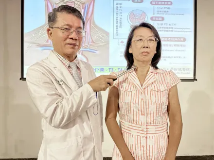 甲狀腺亢進1個半月暴瘦14公斤！中國附醫採「中西醫合併」治療恢復健康