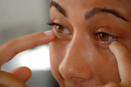 換季當心！38歲女子左眼癢爆　就醫一看竟是「過敏性結膜炎」惹禍