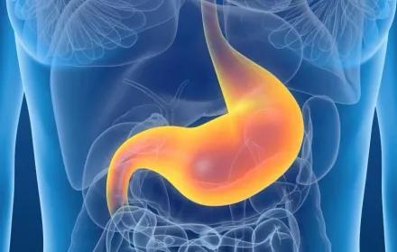 胃癌風險增6倍！「幽門桿菌」是一級致癌物　家人相互傳染為大宗